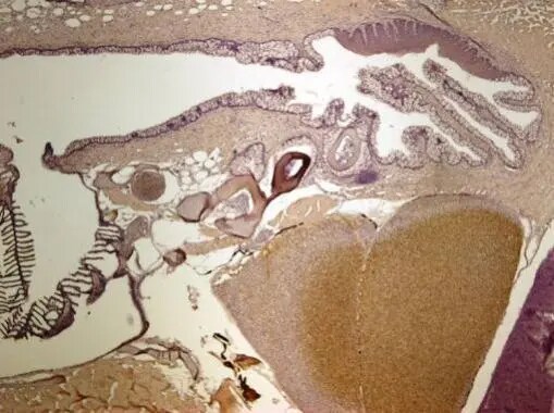 ALDH2 Antibody