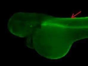 ENO3 Antibody