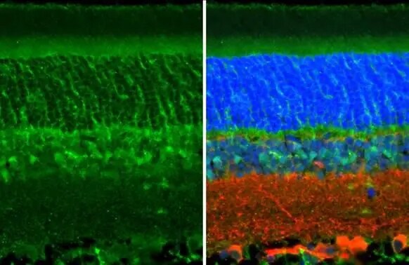 CRALBP Antibody