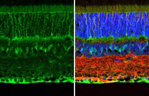 CRALBP Antibody