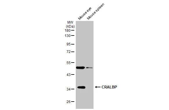 CRALBP Antibody - BSA Free