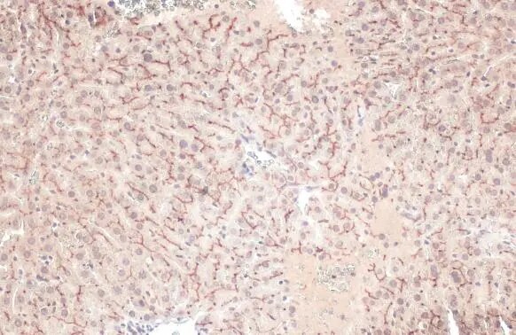 ABCB11 Antibody