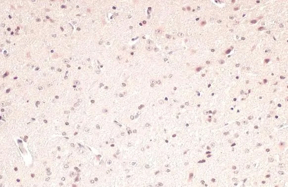 PPAR alpha/NR1C1 Antibody