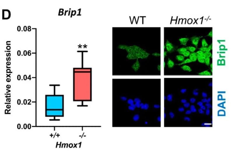 BRIP1/FANCJ Antibody