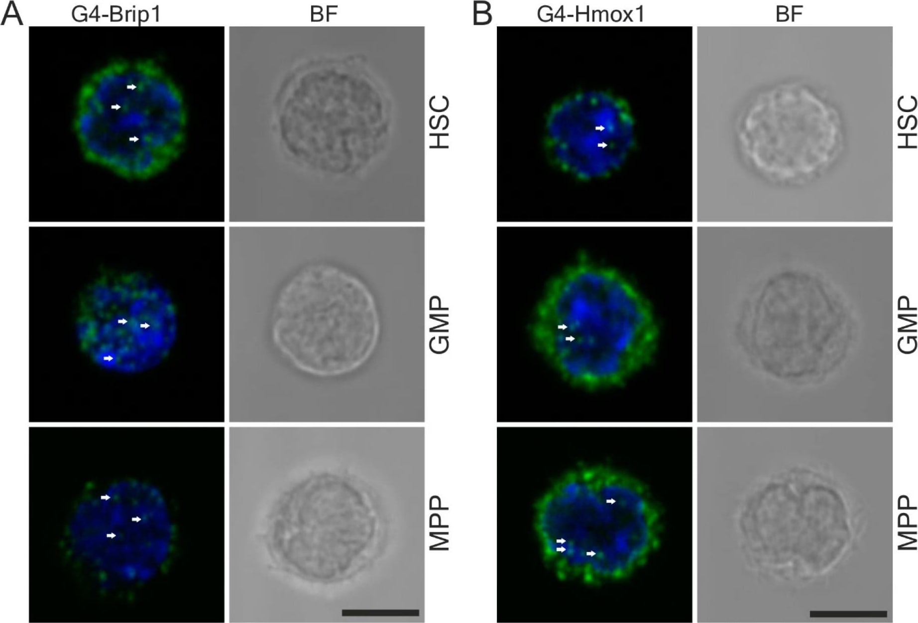 BRIP1/FANCJ Antibody