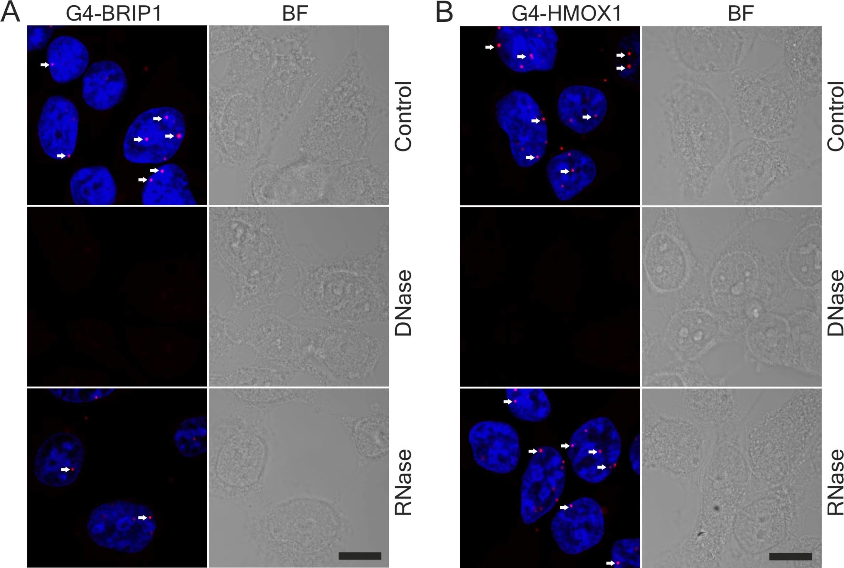 BRIP1/FANCJ Antibody