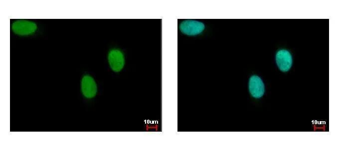 BRIP1/FANCJ Antibody - BSA Free