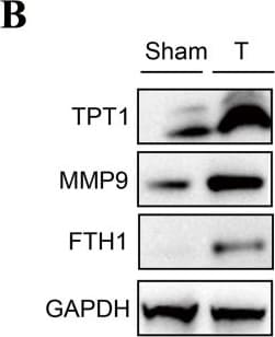 Ferritin Heavy Chain Antibody - BSA Free