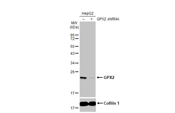 Glutathione Peroxidase 2/GPX2 Antibody