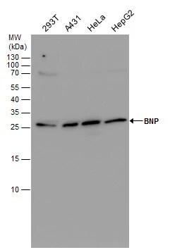 BNP Antibody