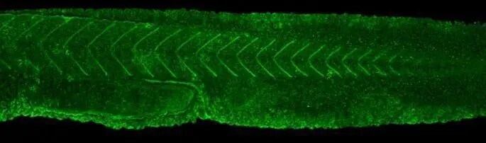 Fyn Antibody
