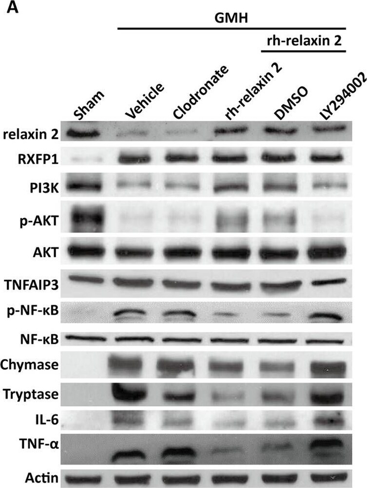 NFkB2/NFkB p100 Antibody - BSA Free