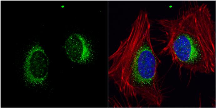 ORP150/HSP12A Antibody - BSA Free
