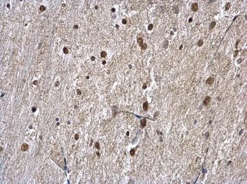 hnRNP A1 Antibody