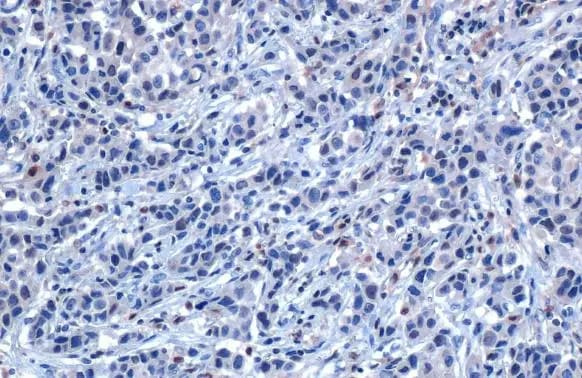 SHP-1 Antibody
