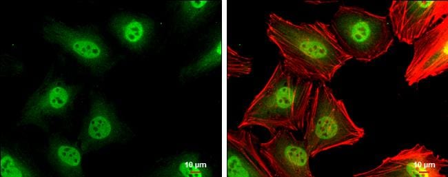 p27/Kip1 Antibody