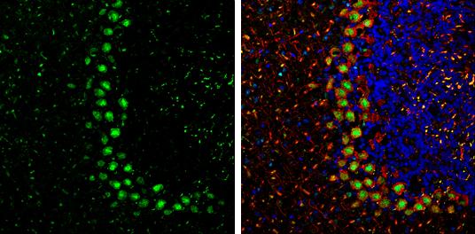 Protein Phosphatase 1 beta Antibody - BSA Free