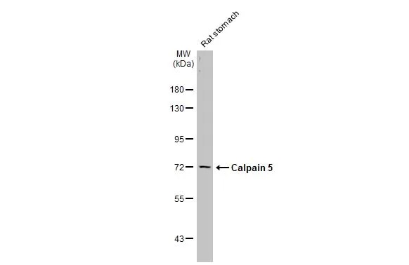 Calpain 5 Antibody