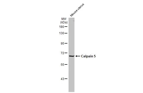 Calpain 5 Antibody