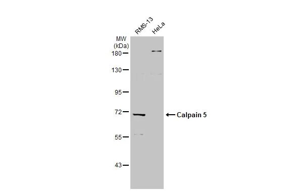Calpain 5 Antibody