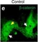 beta-Catenin Antibody