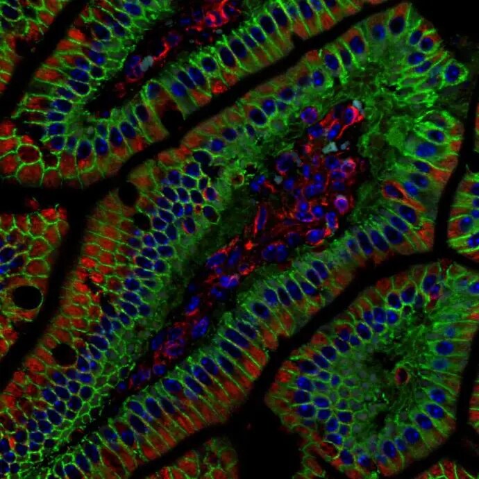 beta-Catenin Antibody