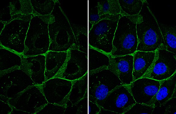 beta-Catenin Antibody
