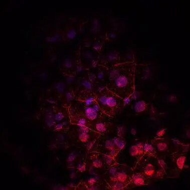 beta-Catenin Antibody