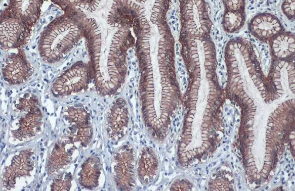 beta-Catenin Antibody