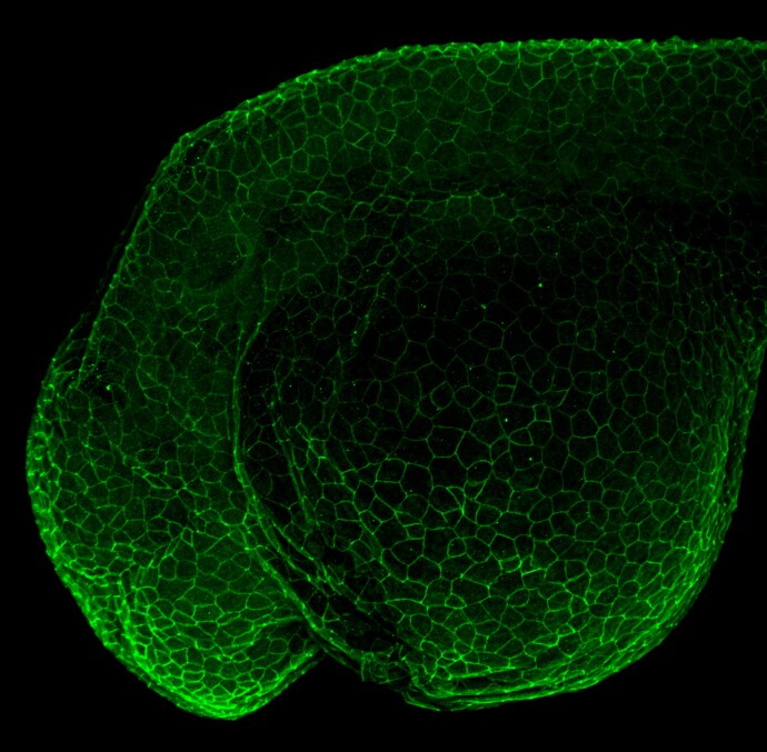 beta-Catenin Antibody