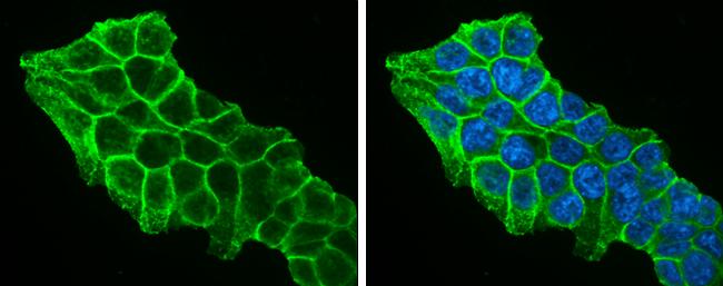beta-Catenin Antibody
