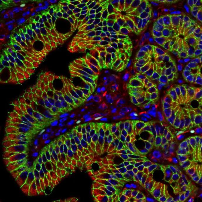 beta-Catenin Antibody