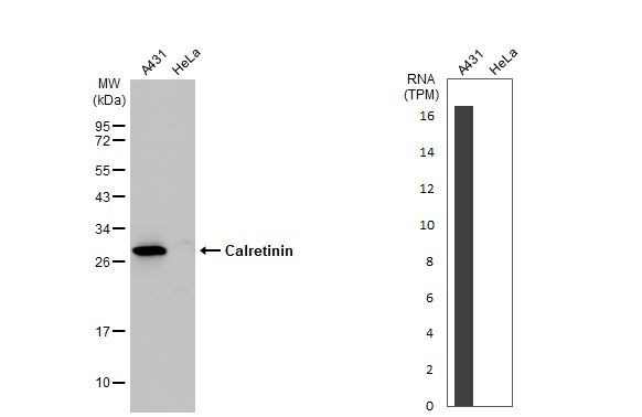 Calretinin Antibody - BSA Free