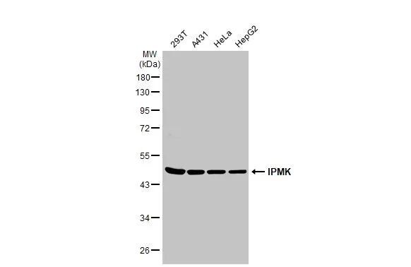 IPMK Antibody - BSA Free