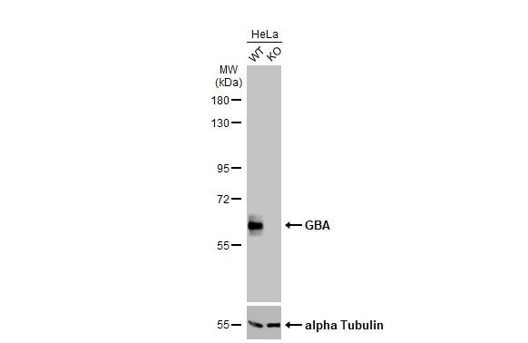 Glucosylceramidase/GBA Antibody