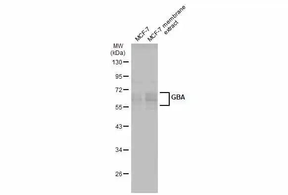 Glucosylceramidase/GBA Antibody