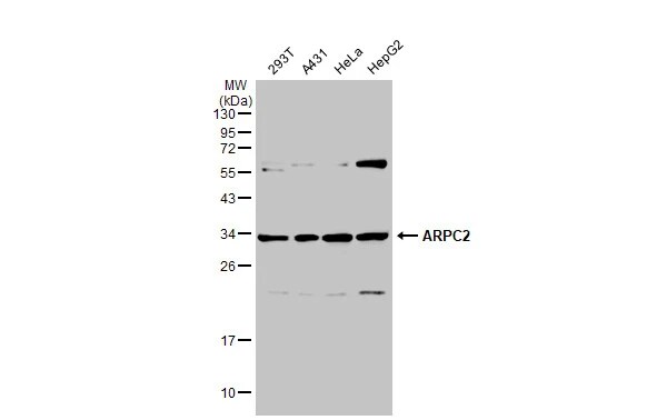 ARPC2 Antibody