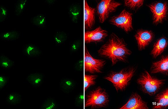 GALNT2 Antibody