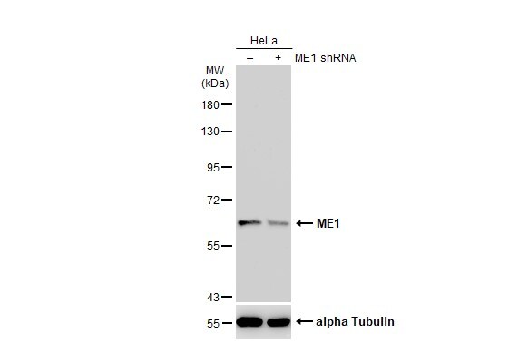 ME1 Antibody
