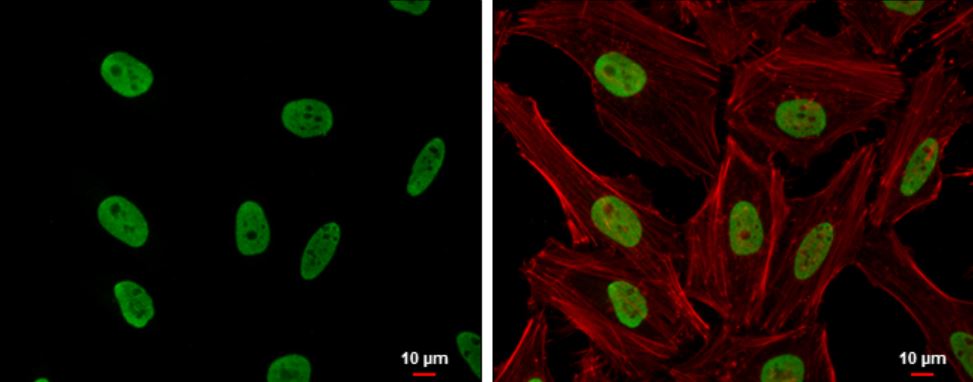 CSB Antibody