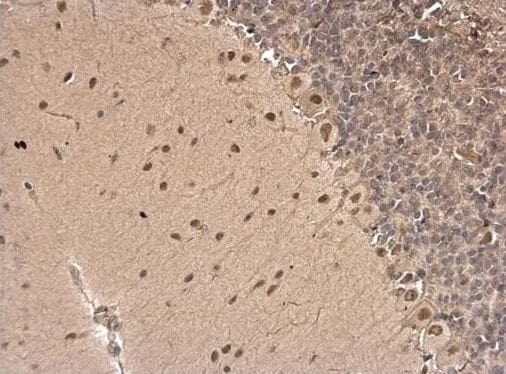CSB Antibody