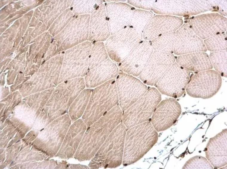 CSB Antibody