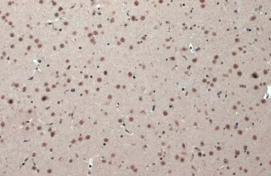 CSB Antibody