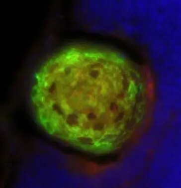 Proteasome 20S alpha 6 Antibody