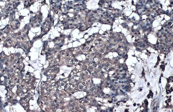 GGT1 Antibody