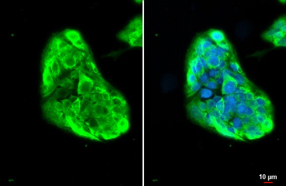 Fibrinogen gamma chain Antibody