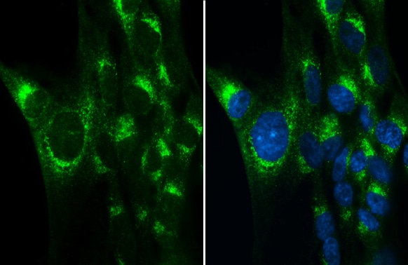 Albumin Antibody