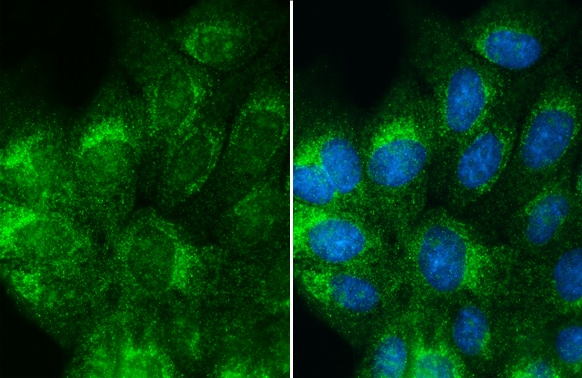 Albumin Antibody