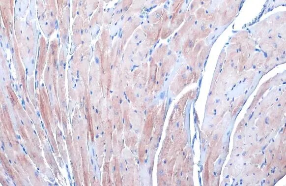 Alpha Actinin 2 Antibody