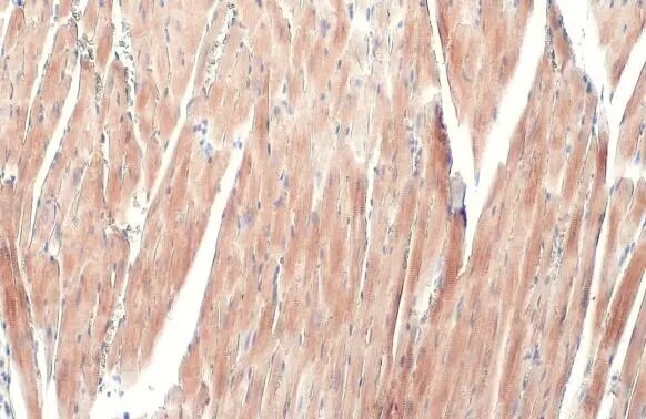 Alpha Actinin 2 Antibody